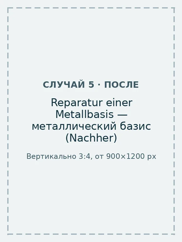 Prothese mit reparierter Metallbasis nach der Reparatur